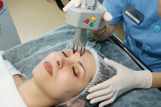 Lasersko frakcijsko pomlađivanje kože lica
