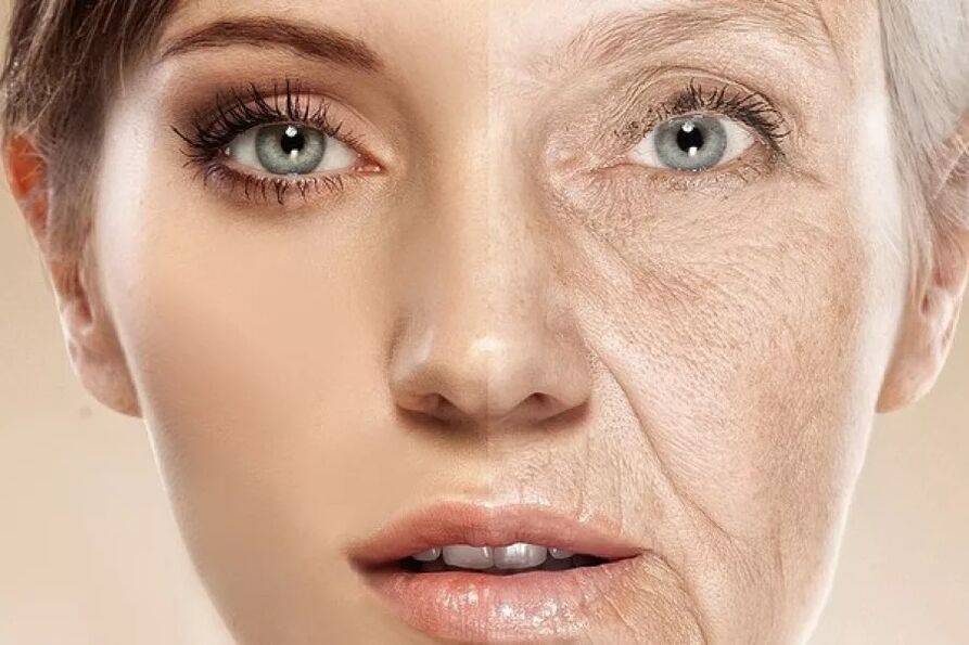Koža lica nakon i prije izlaganja frakcijskom ablativnom laseru